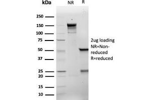 SDS-PAGE Analysis Purified p21 Recombinant Mouse Monoclonal Antibody (rCIP1/6907). (Recombinant p21 抗体  (AA 1-100))