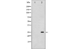 Western blot analysis of p27 Kip1 phosphorylation expression in A2780 whole cell lysates,The lane on the left is treated with the antigen-specific peptide. (CDKN1B 抗体  (pSer10))