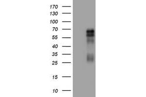 Image no. 1 for anti-Tumor Necrosis Factor Receptor Superfamily, Member 8 (TNFRSF8) (AA 19-379) antibody (ABIN1491091) (TNFRSF8 抗体  (AA 19-379))
