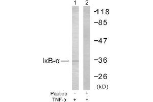Western Blotting (WB) image for anti-Nuclear Factor of kappa Light Polypeptide Gene Enhancer in B-Cells Inhibitor, alpha (NFKBIA) (Ser32), (Ser36) antibody (ABIN1848117) (NFKBIA 抗体  (Ser32, Ser36))