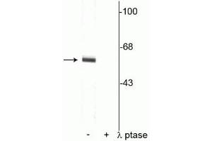 Western blot of rat cortical lysate showing specific immunolabeling of the ~62 kDa synaptotagmin phosphorylated at Thr202 in the first lane (-). (SYT1 抗体  (pThr202))