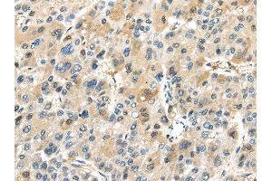 Immunohistochemistry (IHC) image for anti-TRAF Interacting Protein (TRAIP) antibody (ABIN5957748) (TRAIP 抗体)