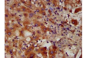 IHC image of ABIN7163270 diluted at 1:400 and staining in paraffin-embedded human liver tissue performed on a Leica BondTM system. (PACS2 抗体  (AA 268-465))