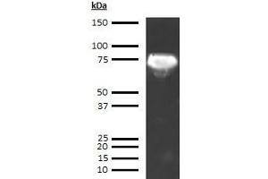 Western Blotting (WB) image for anti-alpha-Fetoprotein (AFP) antibody (ABIN613541) (alpha Fetoprotein 抗体)