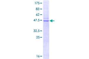 Image no. 1 for Caveolin 1, Caveolae Protein, 22kDa (CAV1) (AA 1-178) protein (GST tag) (ABIN1348146) (Caveolin-1 Protein (AA 1-178) (GST tag))