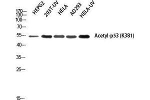 Western Blot (WB) analysis of HepG2 293T-UV HeLa AD293 HeLa-UV using Acetyl-p53 (K381) Polyclonal Antibody. (p53 抗体  (acLys381))
