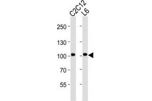 Western blot analysis of lysate from C2C12, L6 cell line (left to right) using Musk antibody at 1:2000 for each lane. (MUSK 抗体)