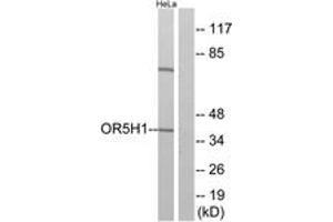 Western blot analysis of extracts from HeLa cells, using OR5H1 Antibody. (OR5H1 抗体  (AA 262-311))
