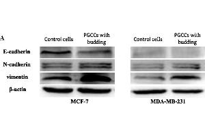 Western Blotting (WB) image for anti-Vimentin (VIM) (AA 371-466) antibody (ABIN672786)