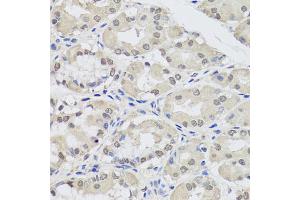 Immunohistochemistry of paraffin-embedded human stomach using AGO2 antibody (ABIN5974124) at dilution of 1/100 (40x lens). (AGO2 抗体)