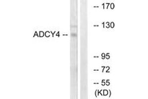 Western Blotting (WB) image for anti-Adenylate Cyclase 4 (ADCY4) (AA 195-244) antibody (ABIN2889852) (ADCY4 抗体  (AA 195-244))