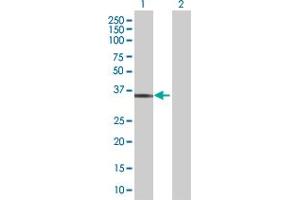 Western Blotting (WB) image for SULT1E1 293T Cell Transient Overexpression Lysate(Denatured) (ABIN1333604)