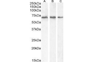 Western Blotting (WB) image for anti-phosphoenolpyruvate Carboxykinase 2 (Mitochondrial) (PEPCK) (Internal Region) antibody (ABIN185483)