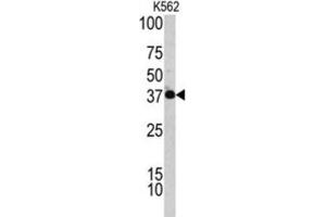 Western Blotting (WB) image for anti-Complement Factor H-Related 1 (CFHR1) antibody (ABIN3002714) (CFHR1 抗体)