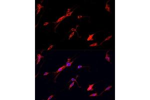 Immunofluorescence analysis of PC12 cells using ENO2 antibody. (ENO2/NSE 抗体  (AA 195-434))