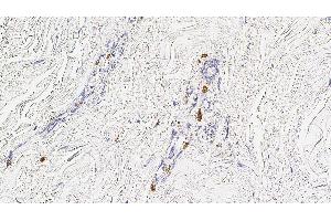 Human skin: immunohistochemical staining for Mast Cell Tryptase. (Mast Cell Tryptase 抗体)