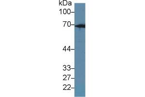 Detection of CK2 in Rat Liver lysate using Polyclonal Antibody to Keratin 2 (CK2) (Keratin 2 抗体  (AA 508-685))