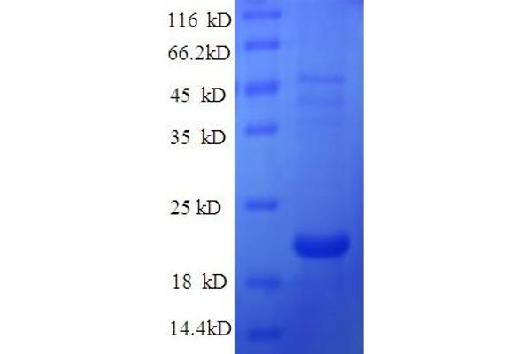 Defb14 Protein (AA 23-67) (His-SUMO Tag)