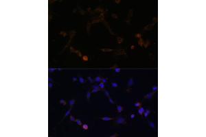 Immunofluorescence analysis of NIH/3T3 cells using UBE2L6 antibody (ABIN6134446, ABIN6149808, ABIN6149809 and ABIN6217753) at dilution of 1:100. (UBE2L6 抗体  (C-Term))