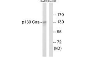 Western Blotting (WB) image for anti-Breast Cancer Anti-Estrogen Resistance 1 (BCAR1) (AA 376-425) antibody (ABIN2888602) (BCAR1 抗体  (AA 376-425))