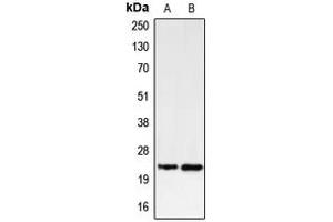 Western blot analysis of PUMA expression in K562 (A), U937 (B) whole cell lysates. (PUMA 抗体  (C-Term))