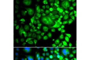 Immunofluorescence analysis of A549 cells using SNX3 Polyclonal Antibody (Sorting Nexin 3 抗体)