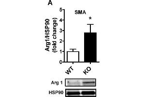 Western Blotting (WB) image for anti-Arginase, Liver (ARG1) antibody (ABIN2856661)