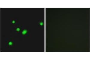 Immunofluorescence analysis of A549 cells, using MUTYH Antibody. (MUTYH 抗体  (AA 151-200))