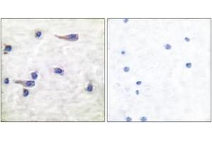 Immunohistochemistry analysis of paraffin-embedded human brain, using Tau (Phospho-Thr212) Antibody. (tau 抗体  (pThr529))