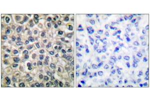 Immunohistochemistry (IHC) image for anti-Junction Plakoglobin (JUP) (C-Term) antibody (ABIN1848448) (JUP 抗体  (C-Term))