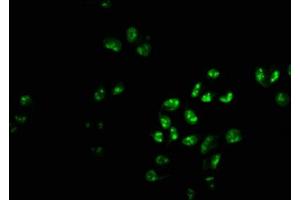 Immunofluorescence staining of Hela cells with ABIN7163056 at 1:233, counter-stained with DAPI. (PHF6 抗体  (AA 2-312))