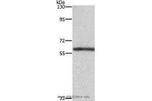 Western blot analysis of Mouse kidney tissue, using TBX5 Polyclonal Antibody at dilution of 1:350 (T-Box 5 抗体)