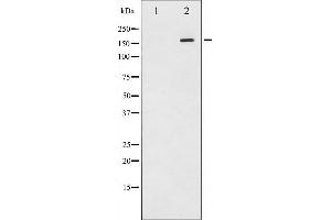 Western blot analysis of EGFR phosphorylation expression in EGF treated A431 whole cell lysates,The lane on the left is treated with the antigen-specific peptide. (EGFR 抗体  (pTyr1110))