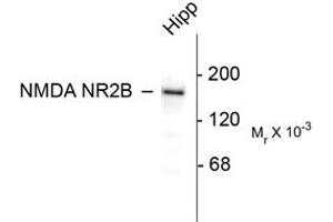 Image no. 1 for anti-Glutamate Receptor, Ionotropic, N-Methyl D-Aspartate 2B (GRIN2B) (C-Term) antibody (ABIN305791) (GRIN2B 抗体  (C-Term))