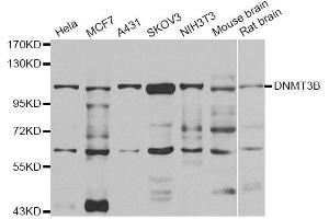 Western blot analysis of extracts of various cell lines, using DNMT3B antibody. (DNMT3B 抗体)