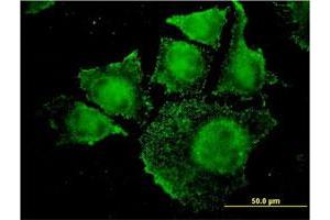 Immunofluorescence of monoclonal antibody to SGK2 on HeLa cell. (SGK2 抗体  (AA 293-367))