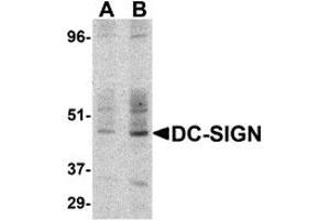 Western Blotting (WB) image for anti-CD209 (CD209) (C-Term) antibody (ABIN1030357) (DC-SIGN/CD209 抗体  (C-Term))