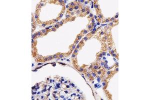 Immunohistochemical analysis of paraffin-embedded H. (AK4 抗体  (AA 119-153))