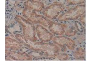 IHC-P analysis of Human Kidney Tissue, with DAB staining. (LGALS8 抗体  (AA 1-317))