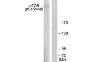 Western Blotting (WB) image for anti-Mechanistic Target of Rapamycin (serine/threonine Kinase) (mTOR) (pSer2448) antibody (ABIN2888475) (MTOR 抗体  (pSer2448))