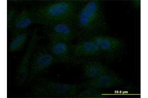 Immunofluorescence (IF) image for anti-POU Class 5 Homeobox 1 (POU5F1) (AA 81-164) antibody (ABIN519056)