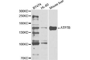 Western Blotting (WB) image for anti-ATPase, Cu++ Transporting, beta Polypeptide (ATP7B) antibody (ABIN1876877) (ATP7B 抗体)