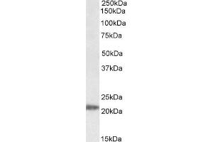 Western Blotting (WB) image for anti-IMP3, U3 Small Nucleolar Ribonucleoprotein (IMP3) antibody (ABIN5935464) (IMP3 抗体)