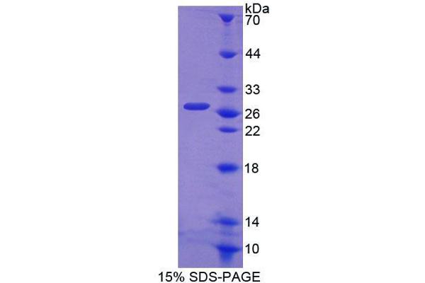 ABCA6 Protein (AA 1398-1616) (T7 tag,His tag)