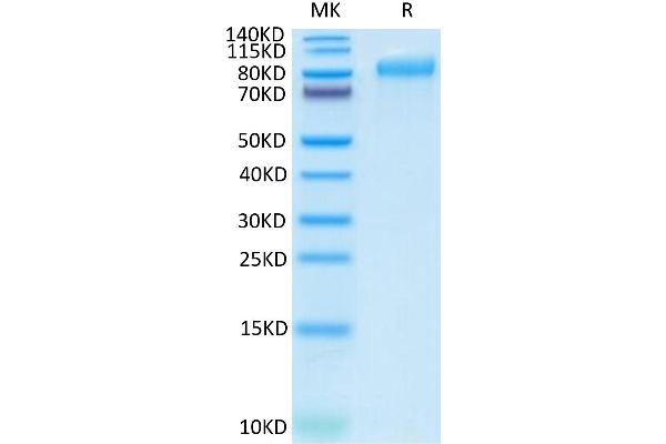 ITGB6 Protein (AA 22-707) (His tag)