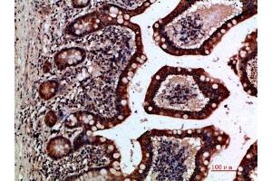 Immunohistochemical analysis of paraffin-embedded human-small-intestine, antibody was diluted at 1:200. (GREM2 抗体  (AA 71-120))