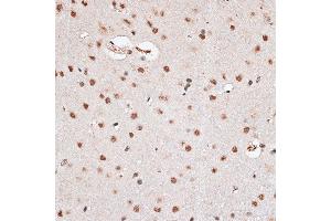 Immunohistochemistry of paraffin-embedded rat brain using RBM3 antibody  at dilution of 1:100 (40x lens). (RBM3 抗体  (AA 1-157))