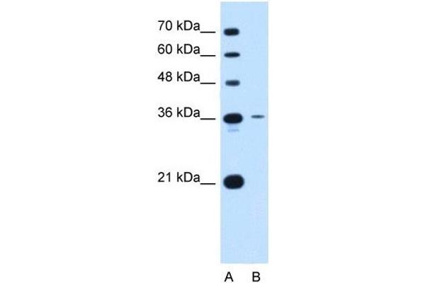 Tetraspanin 5 抗体  (Middle Region)