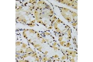 Immunohistochemistry of paraffin-embedded human stomach using ALYREF antibody (ABIN5973579) at dilution of 1/100 (40x lens). (THO Complex 4 抗体)