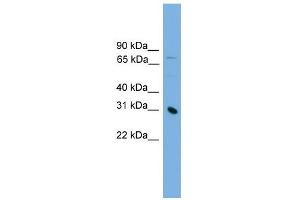 WB Suggested Anti-PRSS8 Antibody Titration: 0. (PRSS8 抗体  (Middle Region))